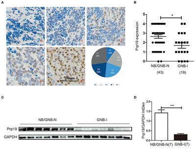 Prp19 Is an Independent Prognostic Marker and Promotes Neuroblastoma Metastasis by Regulating the Hippo-YAP Signaling Pathway
